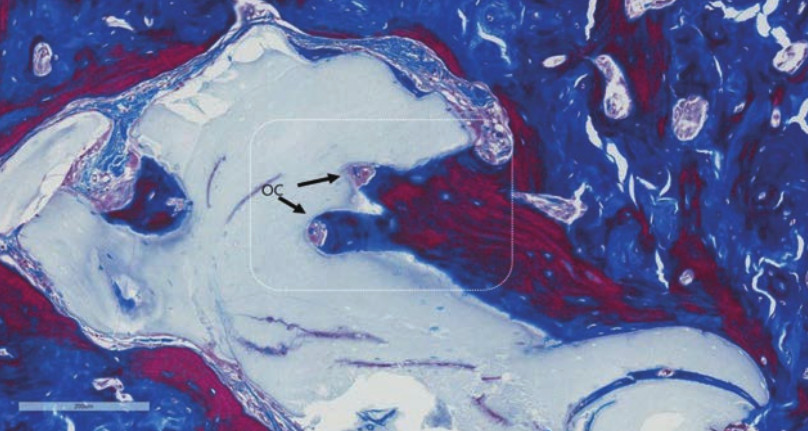 biomateriały pochodzenia wołowego