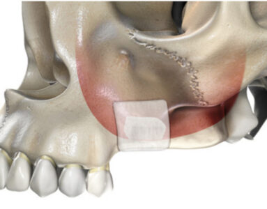 membrany osierdziowe Ubgen