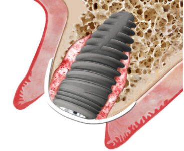 membrany osierdziowe Ubgen