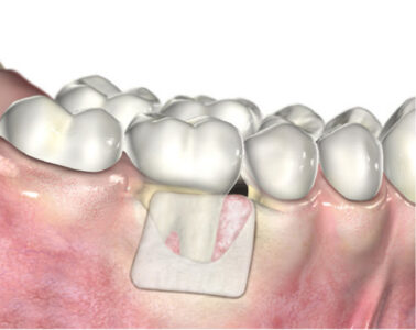 membrany osierdziowe Ubgen