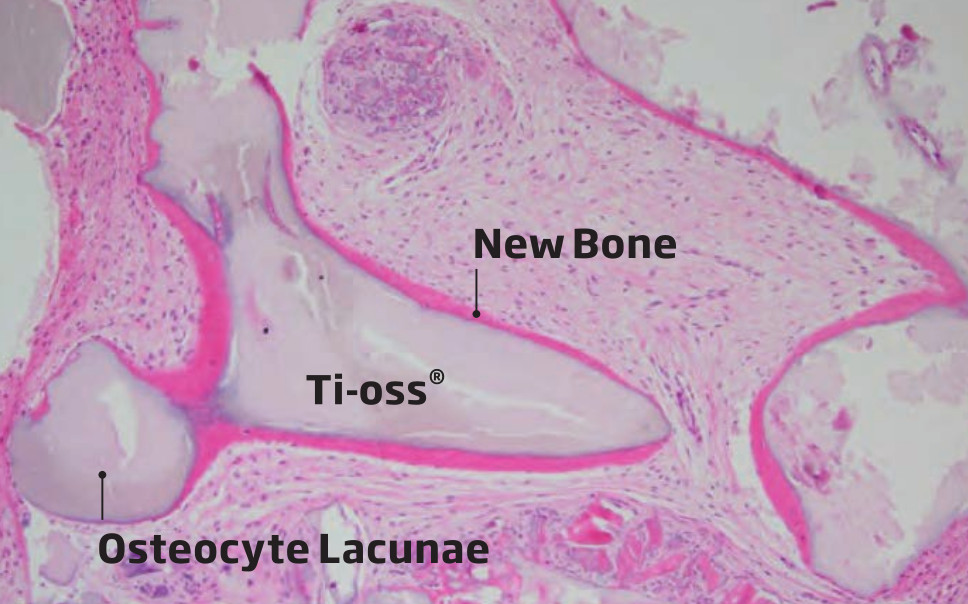 wyniki biopsji po 3 miesiącach