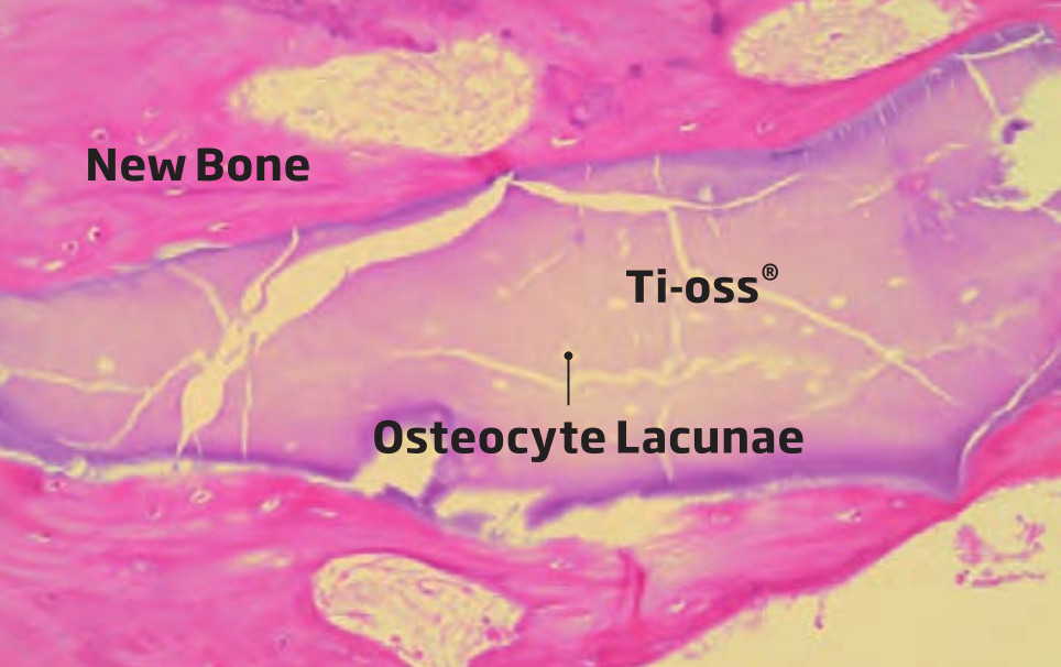 wyniki biopsji po 4 miesiącach