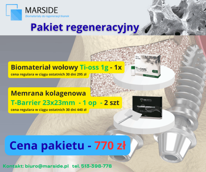 Pakiet regeneracyjny granulacja Ti-oss 1g  1,2-1,7mm - obrazek 1